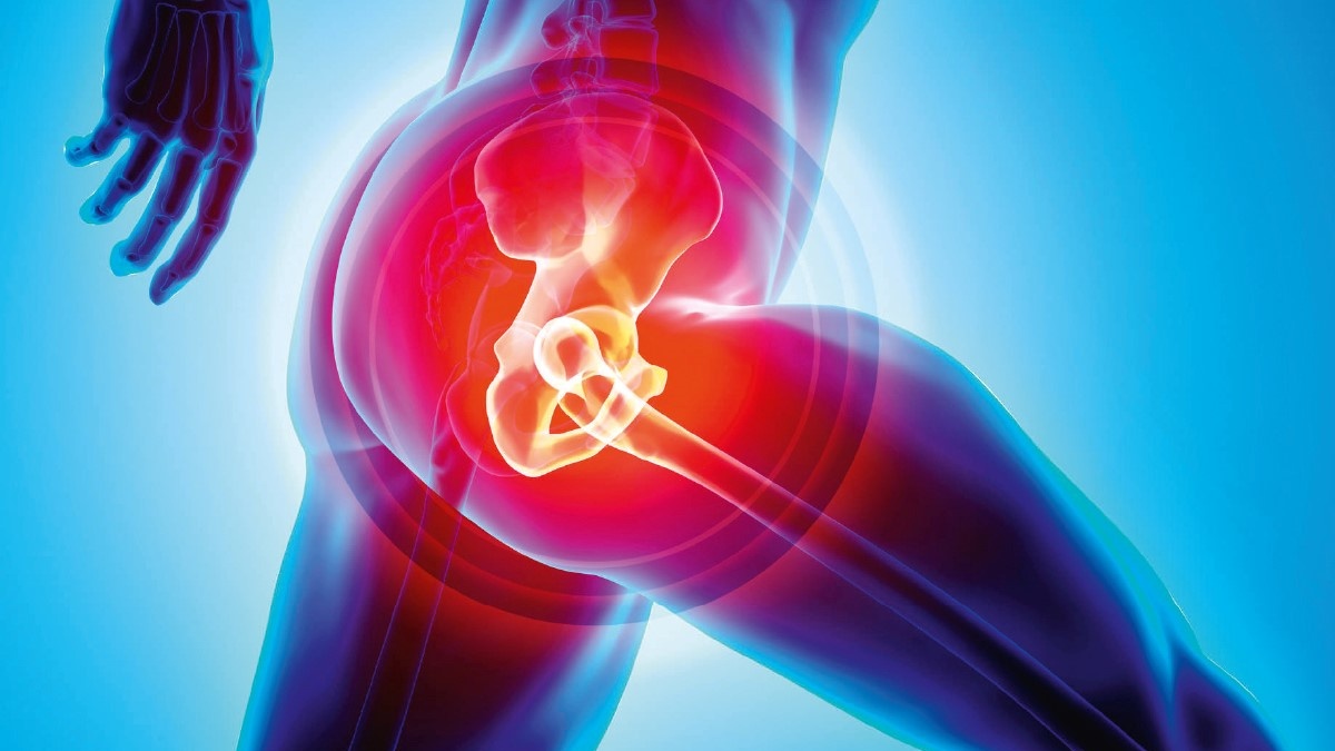 hip-replacement-surgery-guide-why-would-one-need-it-surgery