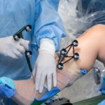 Robotic Knee Replacement Surgery in Chandigarh