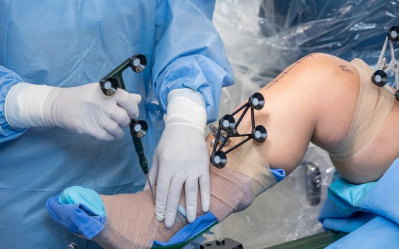 Robotic Knee Replacement Surgery in Chandigarh