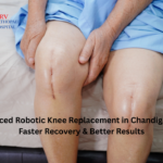 Robotic total knee replacement in Chandigarh